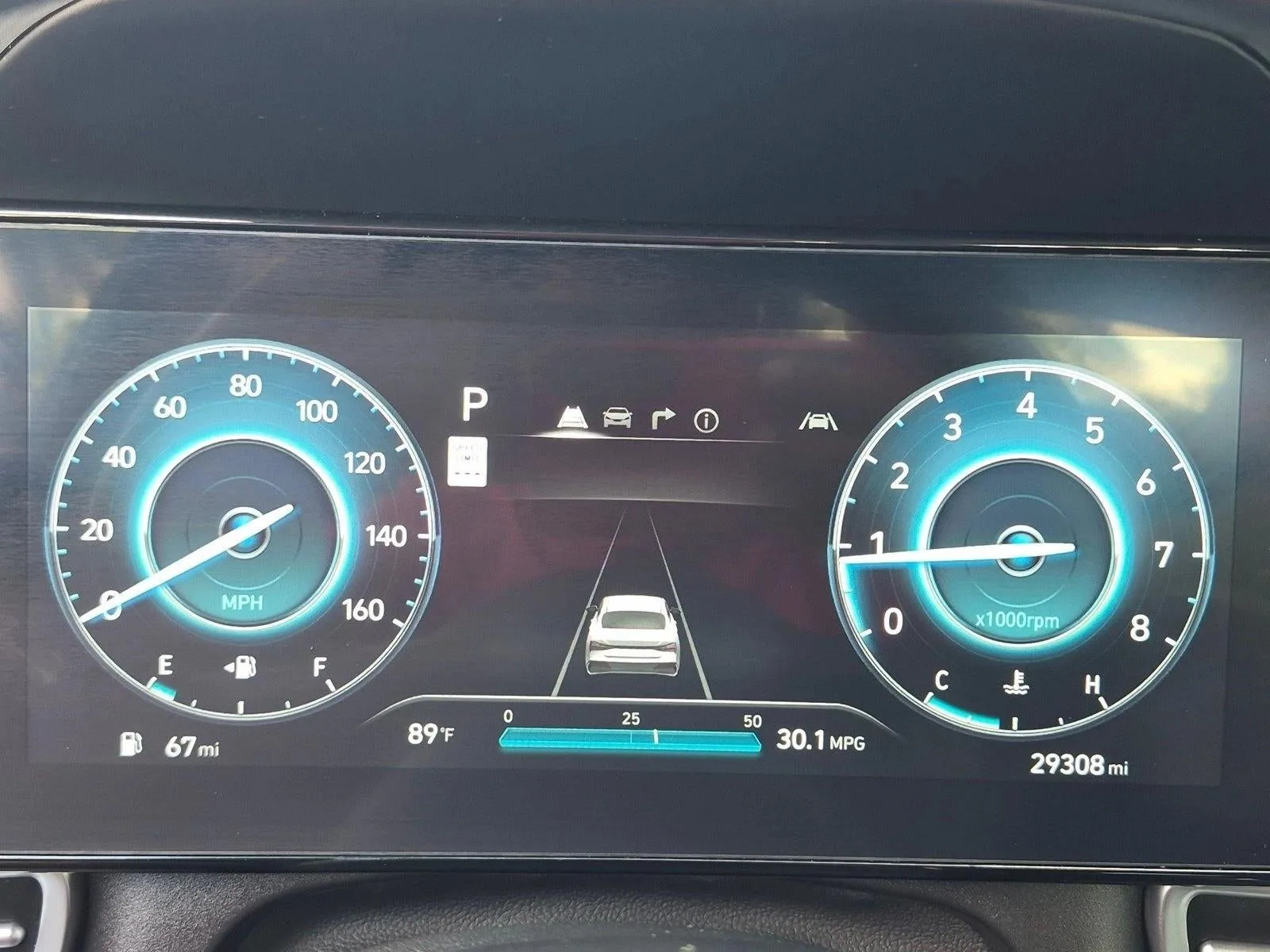 2024 Hyundai ELANTRA SEL IVT photo 10