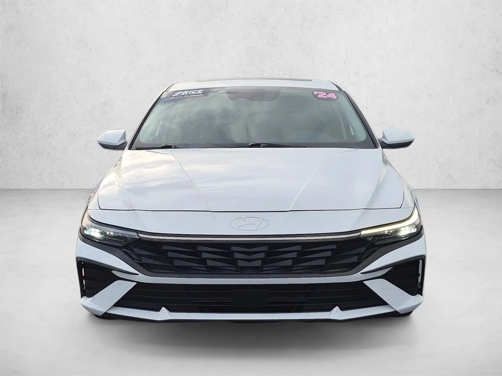 2024 Hyundai ELANTRA SEL IVT photo 2