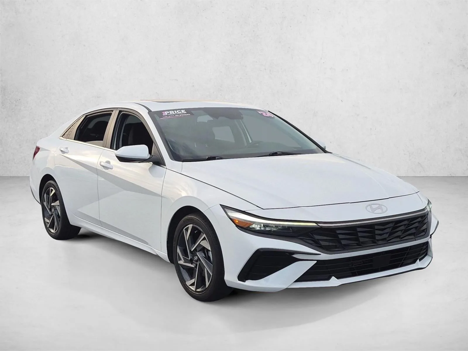 2024 Hyundai ELANTRA SEL IVT photo 3